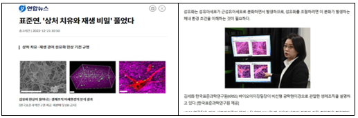 언론보도